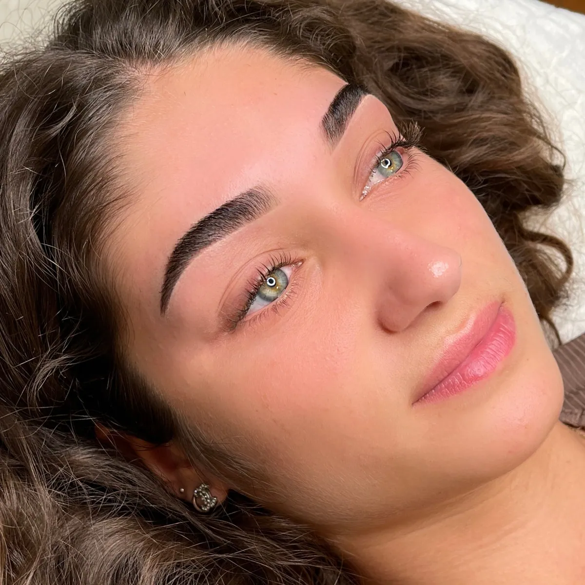 Browlifting – nachher